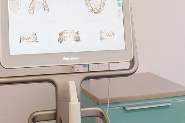 intraoraler-scanner Intraoraler Scanner